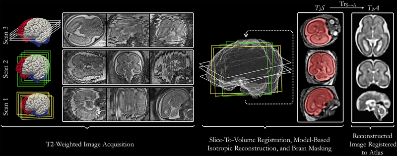 Fig. 1: