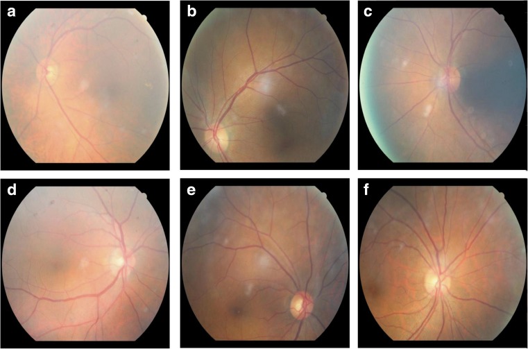 Fig. 1