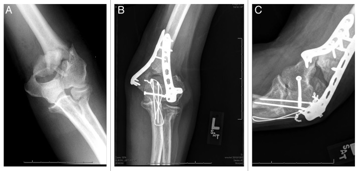 Figure 2: 