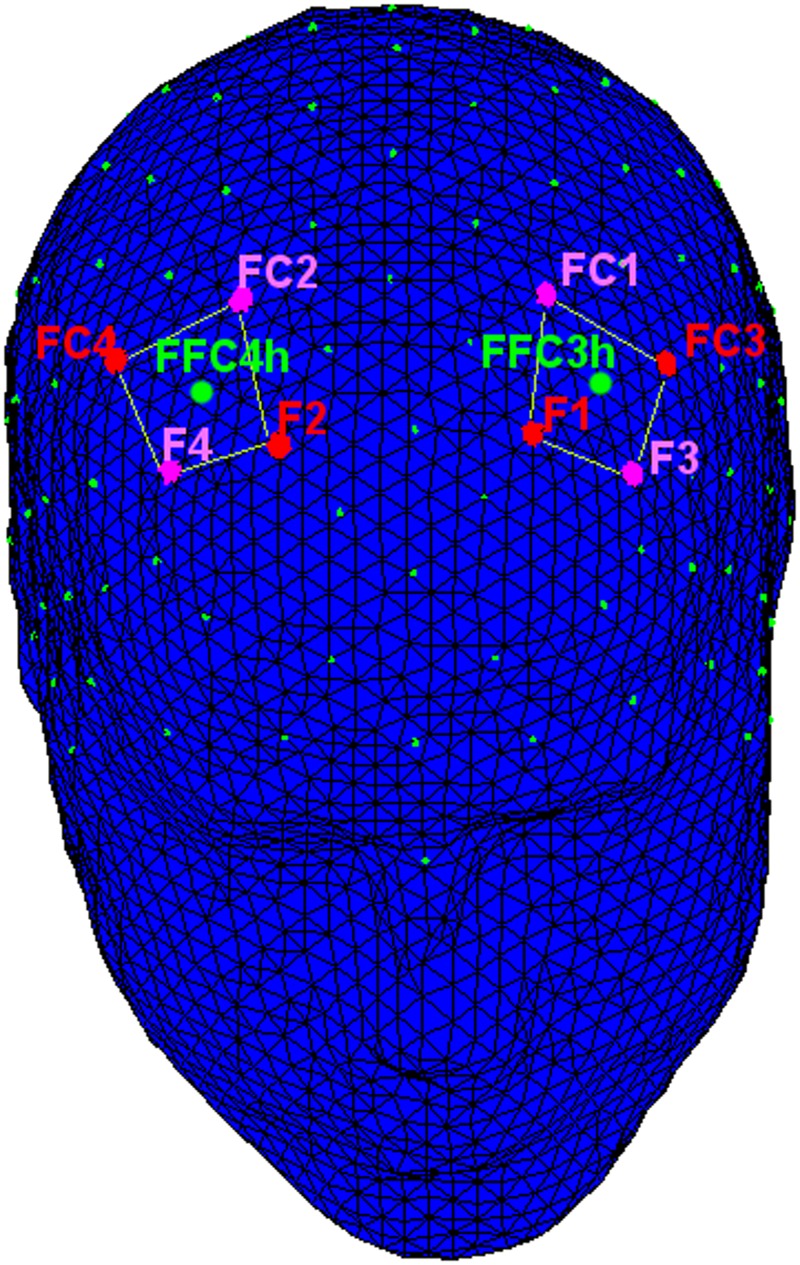 FIGURE 2