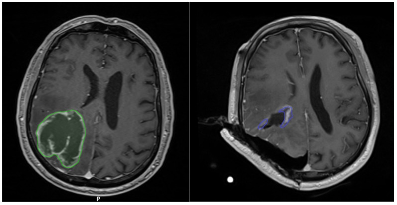 Figure 11