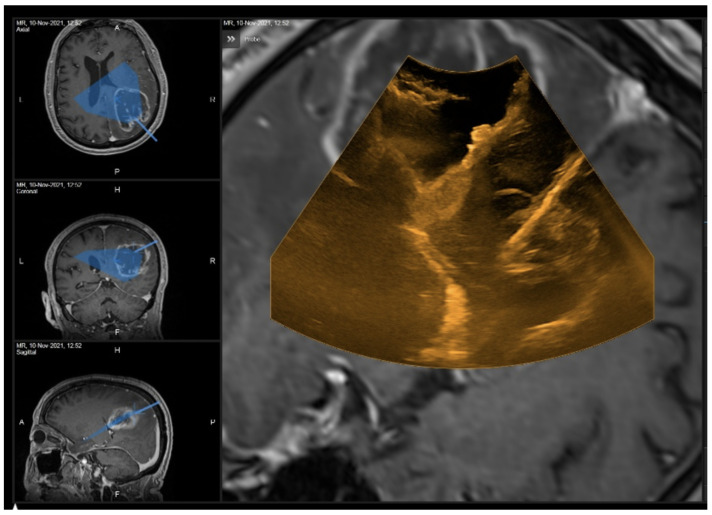 Figure 12