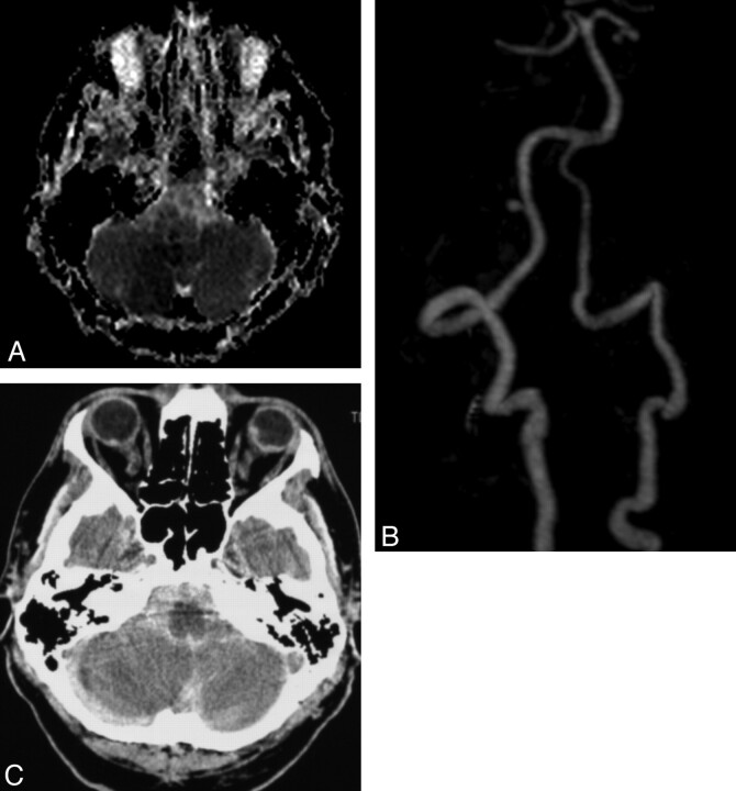 Fig 2.