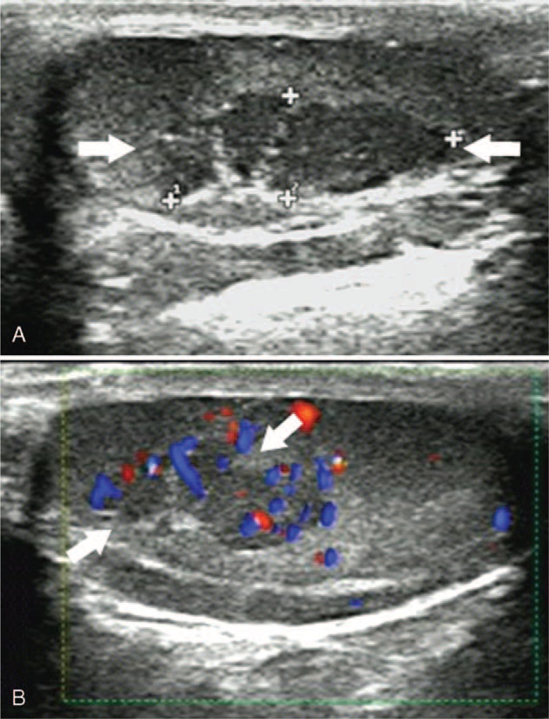 FIGURE 3