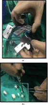 Fig. 4