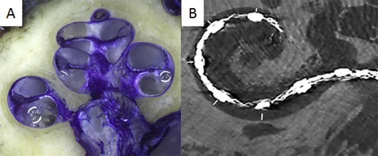 Fig. 2