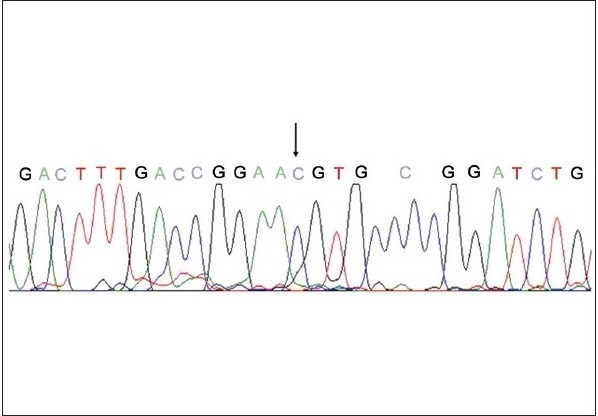 Figure 3a