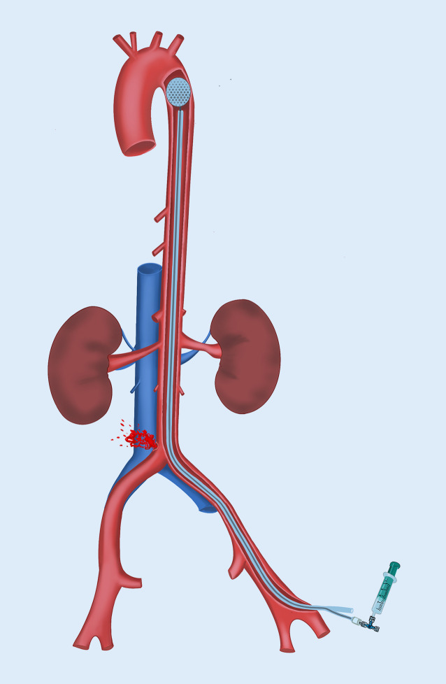 graphic file with name 104_2023_1931_Fig2_HTML.jpg
