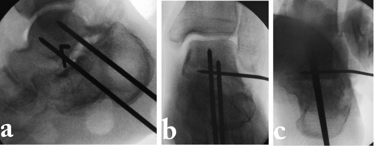 Fig. 7