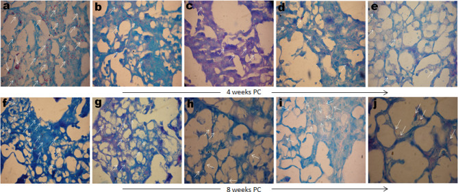 Figure 11