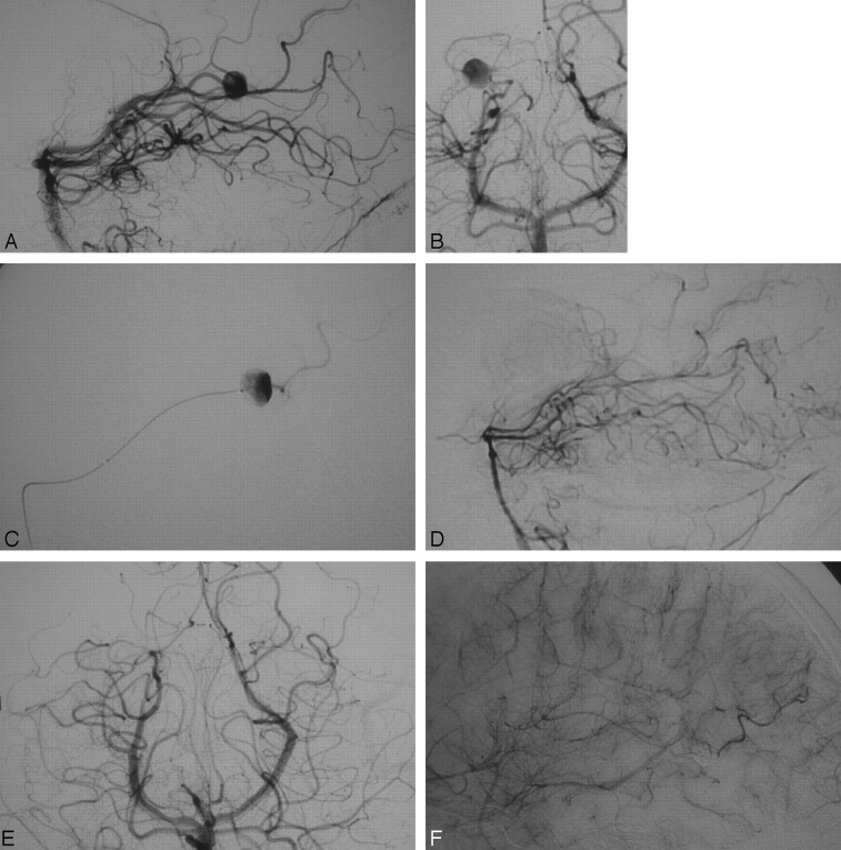 Fig 2.