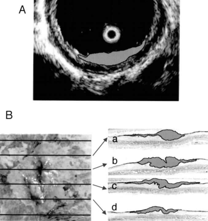 Figure 1  