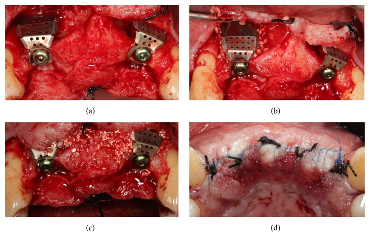 Figure 4