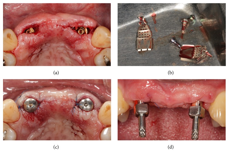 Figure 5