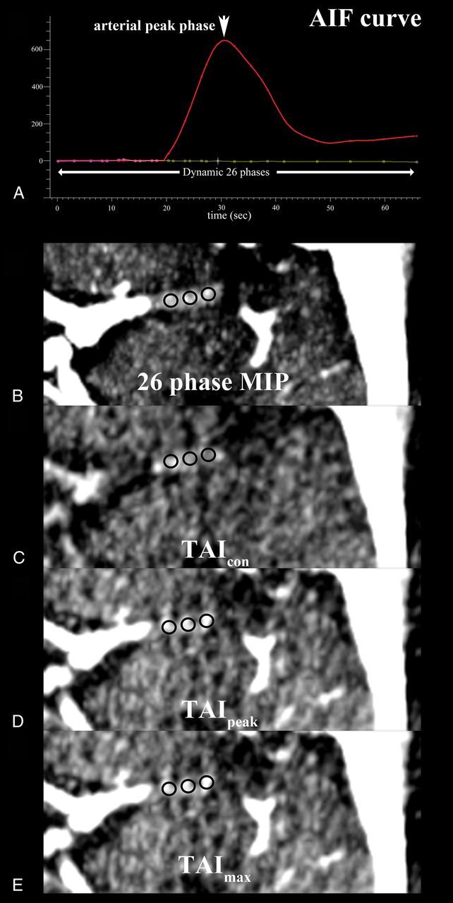 Fig 1.