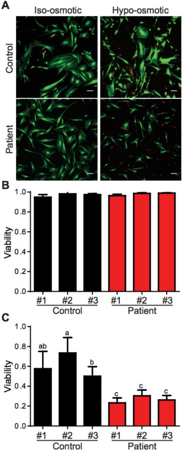 FIGURE 11: