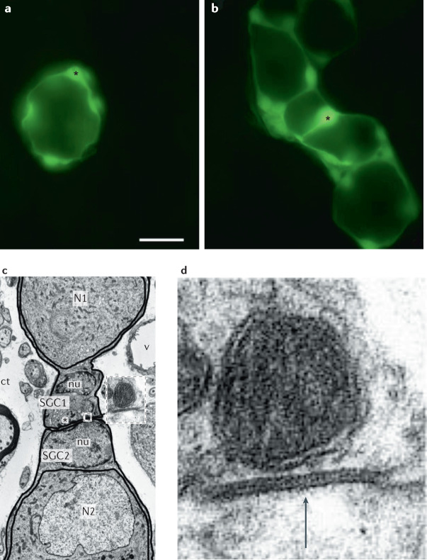 Box 2 Glial activation (gliosis)