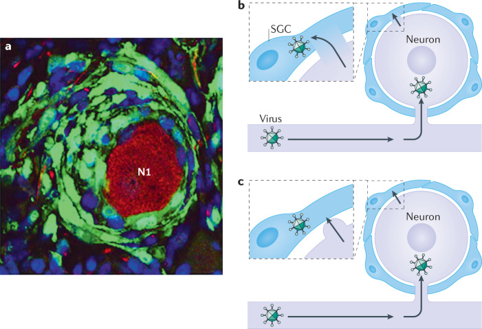 Box 3 SGCs in human disease