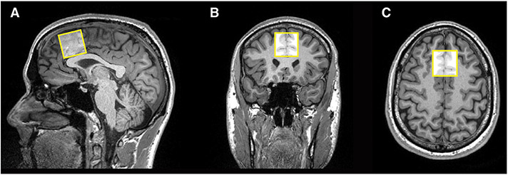 Fig. 2.