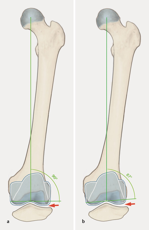 Fig. 5