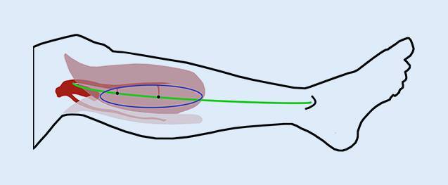 graphic file with name 113_2023_1303_Fig1_HTML.jpg