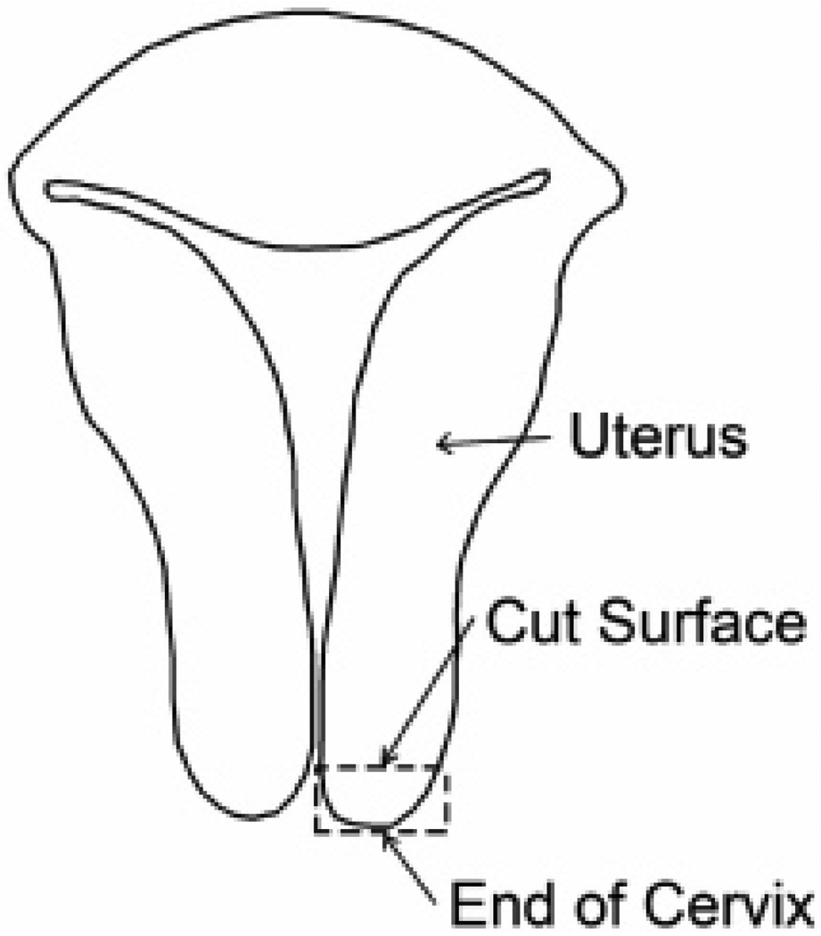 FIG. 1