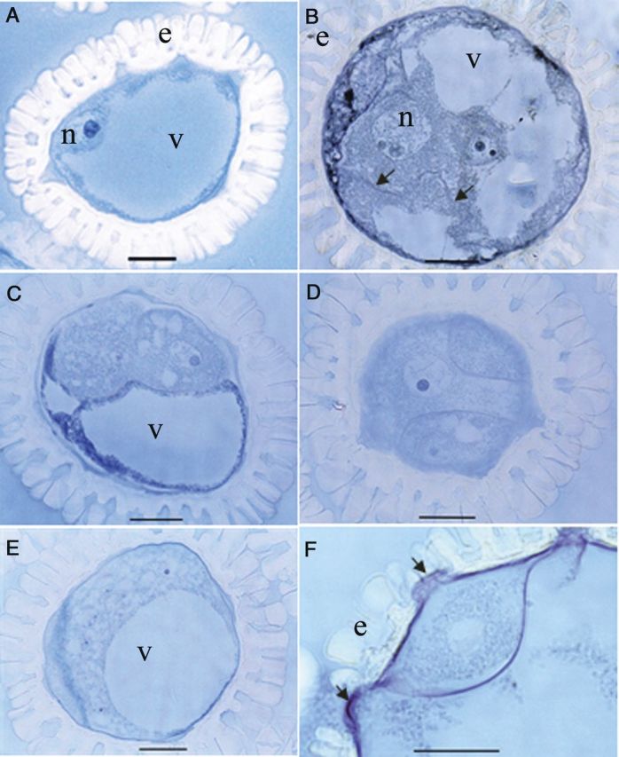 Figure 11.