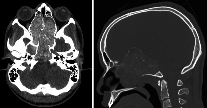 FIG. 1.