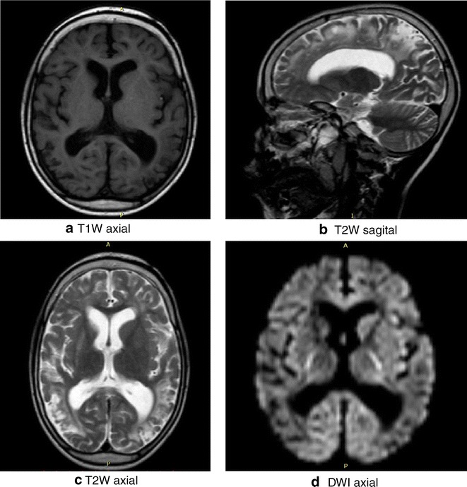 Fig. 3