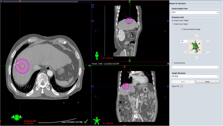 Fig 2