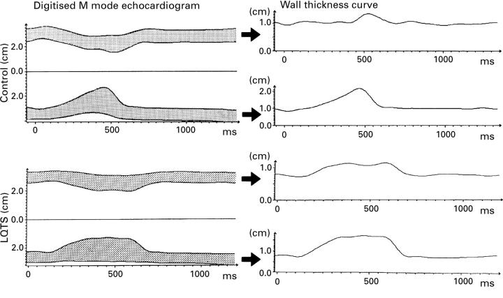 Figure 2  