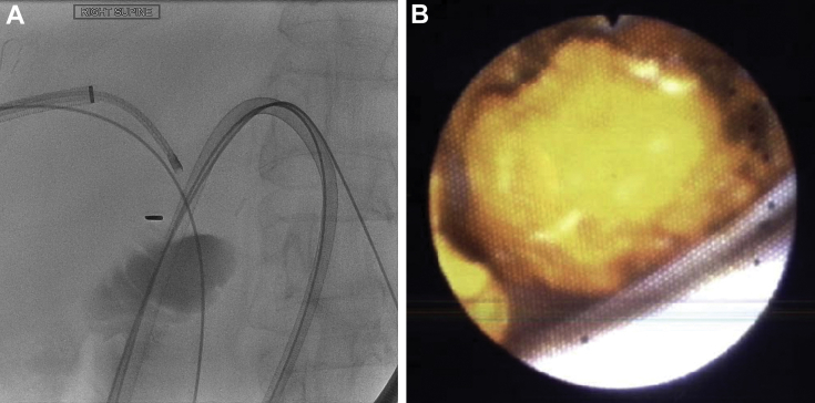 Fig. 4