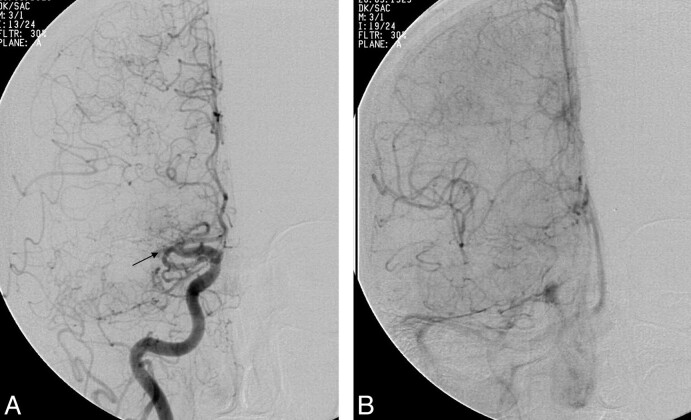 Fig 3.