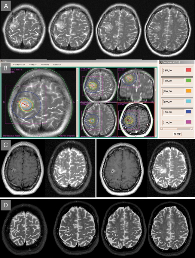 Fig. 4.