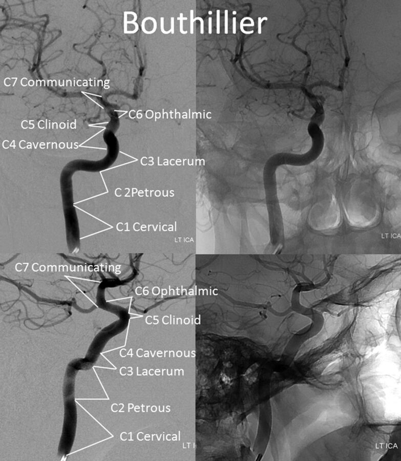 Fig 3.