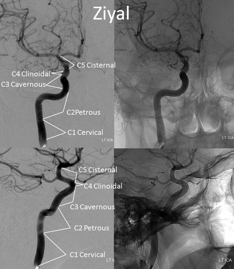 Fig 4.