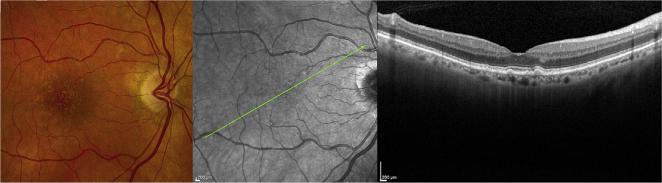 Fig. 1