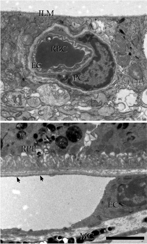 Fig. 14