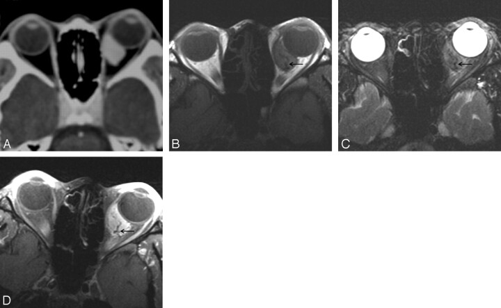 Fig 2.