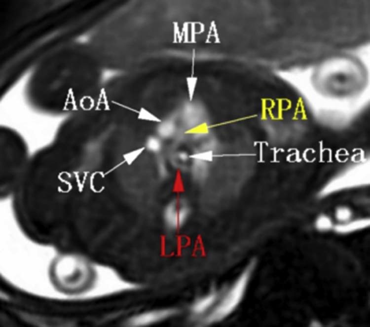 Fig. 5