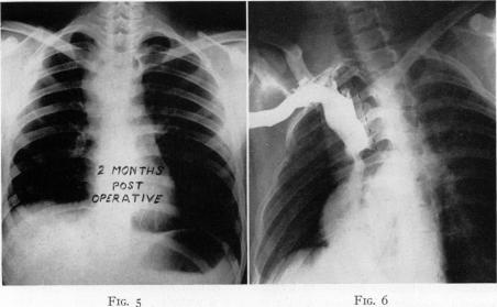 Fig. 5., Fig. 6.