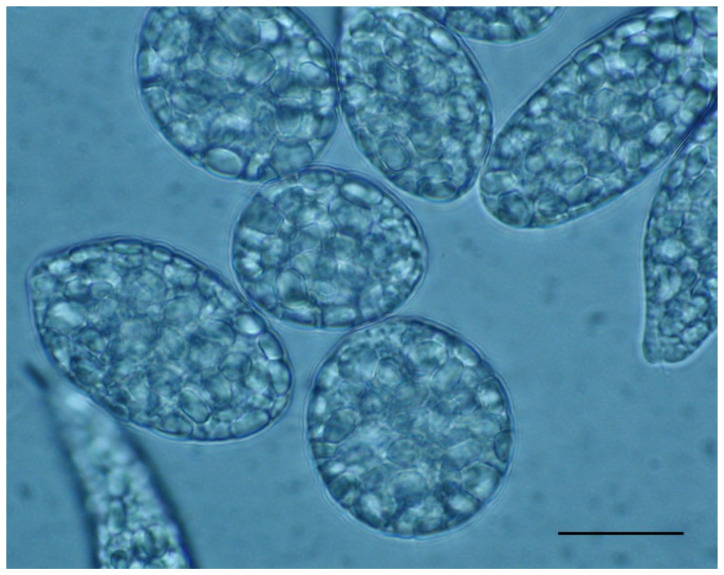 Paramylon and Other Bioactive Molecules in Micro and Macroalgae - PMC