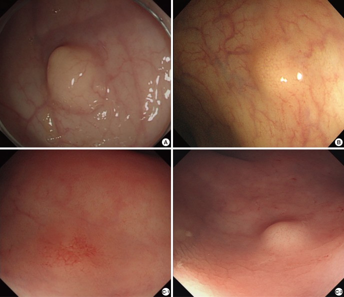 Fig. 1