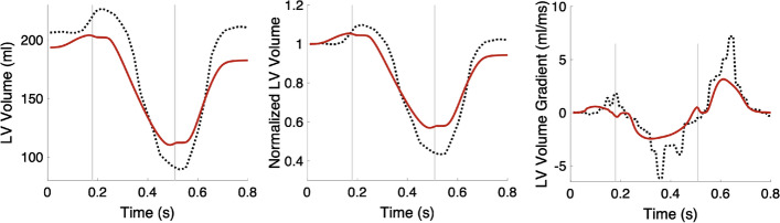 Fig. 12