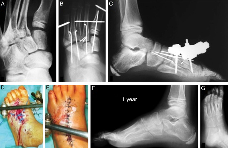 Fig. 6
