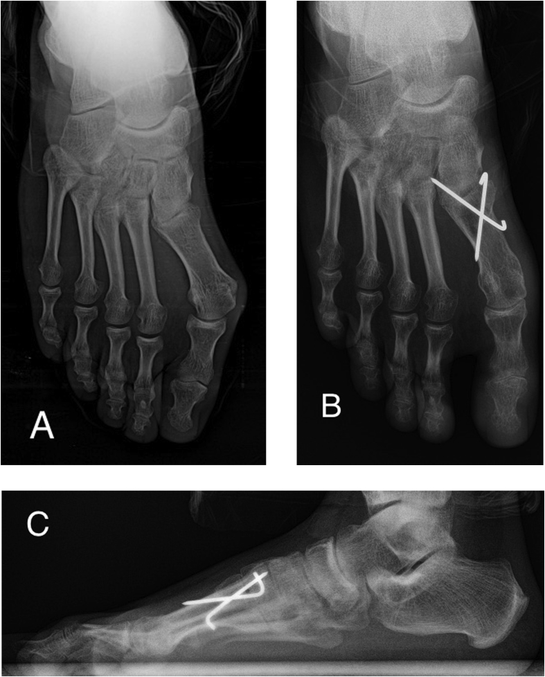 Fig. 2