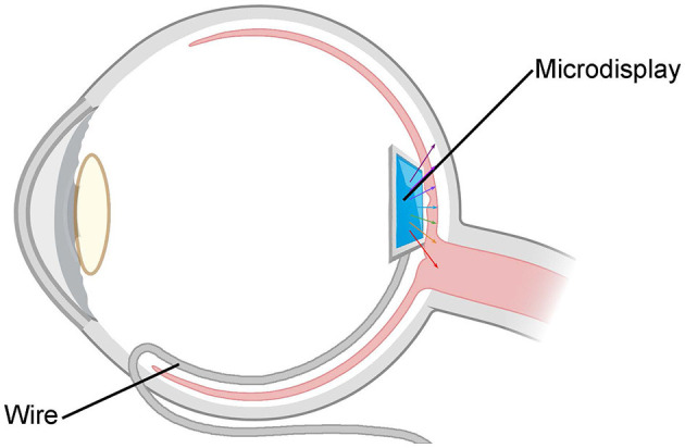 Figure 10