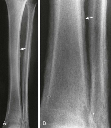 Figure 16-4