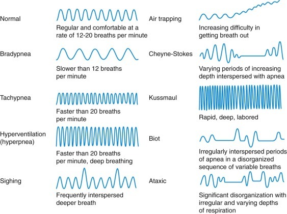 Figure 16-1