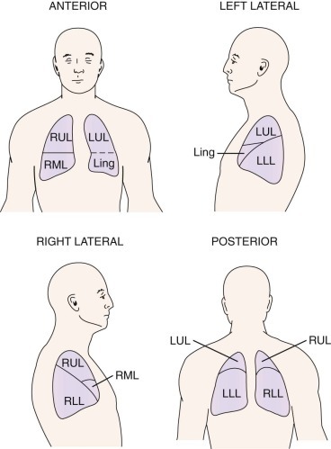 Figure 16-2